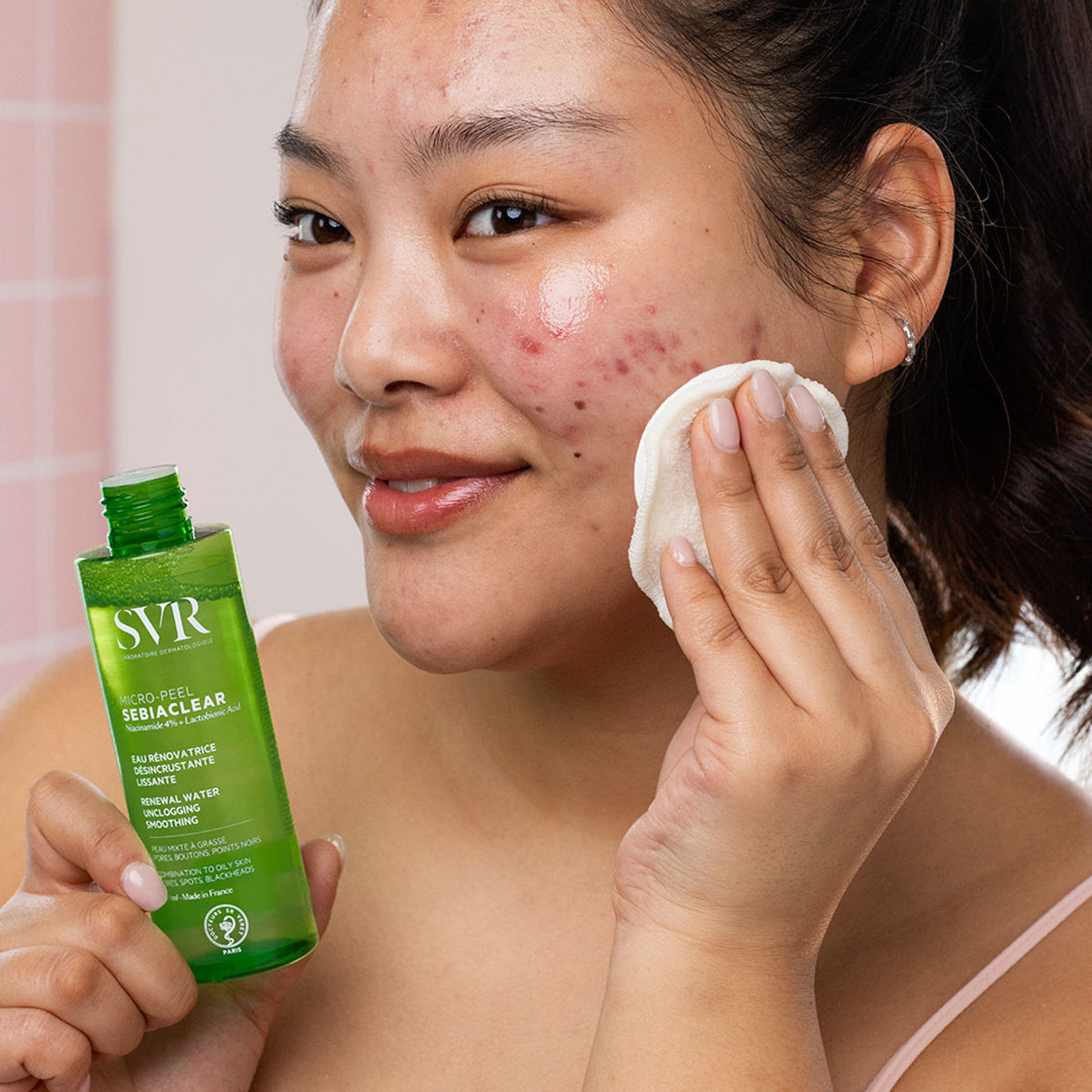 Frau trägt SVR SEBIACLEAR Micro-Peel Wasserlotion mit einem Wattepad auf ihre zu Unreinheiten neigende Haut auf.